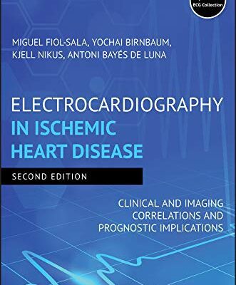 خرید و دانلود نسخه کامل کتاب Electrocardiography in Ischemic Heart Disease: Clinical and Imaging Correlations and Prognostic Implications