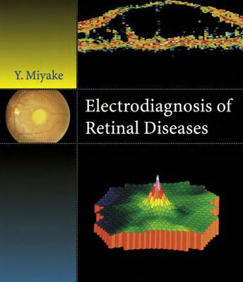 خرید و دانلود نسخه کامل کتاب Electrodiagnosis of Retinal Disease