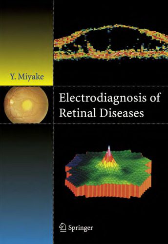 خرید و دانلود نسخه کامل کتاب Electrodiagnosis of Retinal Disease_68b9952bae0c8.jpeg خرید و دانلود نسخه کامل کتاب Electrodiagnosis of Retinal Disease