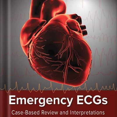 خرید و دانلود نسخه کامل کتاب Emergency ECGs: Case-Based Review and Interpretations by Jeremy Berberian