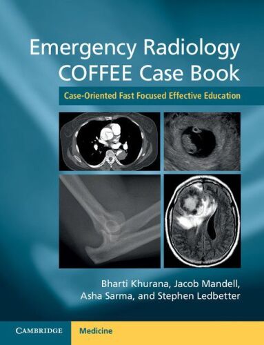 خرید و دانلود نسخه کامل کتاب Emergency radiology COFFEE case book_68bb1b89f1757.jpeg خرید و دانلود نسخه کامل کتاب Emergency radiology COFFEE case book