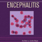 خرید و دانلود نسخه کامل کتاب Encephalitis (Deadly Diseases and Epidemics)