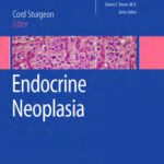 خرید و دانلود نسخه کامل کتاب Endocrine Neoplasia