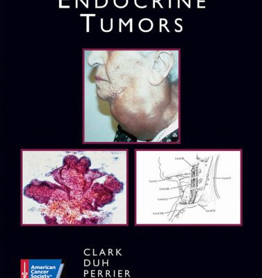 خرید و دانلود نسخه کامل کتاب Endocrine Tumors (Atlas of Clinical Oncology)