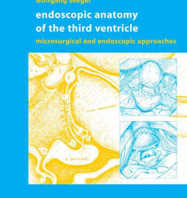 خرید و دانلود نسخه کامل کتاب Endoscopic Anatomy of the Third Ventricle