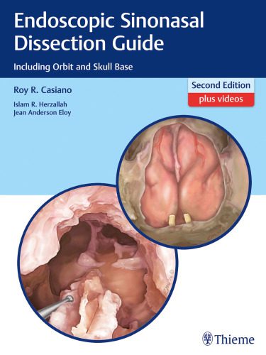 خرید و دانلود نسخه کامل کتاب Endoscopic Sinonasal Dissection Guide: Including Orbit and Skull Base_68bc2e61d1d9a.jpeg خرید و دانلود نسخه کامل کتاب Endoscopic Sinonasal Dissection Guide: Including Orbit and Skull Base