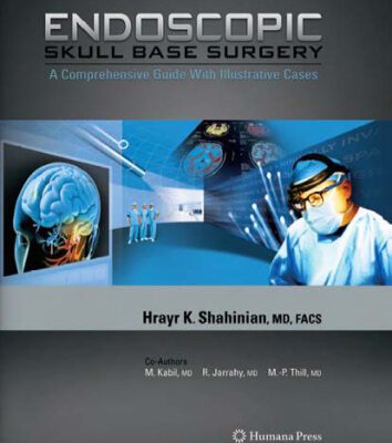 خرید و دانلود نسخه کامل کتاب Endoscopic Skull Base Surgery: A Comprehensive Guide with Illustrative Cases