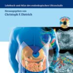 خرید و دانلود نسخه کامل کتاب Endosonographie: Leitfaden und Atlas: Lehrbuch und Atlas des endoskopischen Ultraschalls