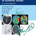 خرید و دانلود نسخه کامل کتاب Endovascular Management of Ischemic Stroke: A Case-based Approach