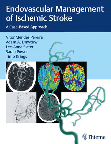خرید و دانلود نسخه کامل کتاب Endovascular Management of Ischemic Stroke: A Case-based Approach_68bb4a6885f60.jpeg خرید و دانلود نسخه کامل کتاب Endovascular Management of Ischemic Stroke: A Case-based Approach