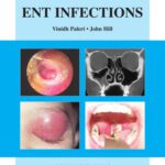 خرید و دانلود نسخه کامل کتاب ENT Infections: An Atlas of Investigation and Management