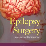 خرید و دانلود نسخه کامل کتاب Epilepsy Surgery: Principles and Controversies (Neurological Disease and Therapy)