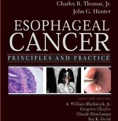 خرید و دانلود نسخه کامل کتاب Esophageal Cancer: Principles and Practice