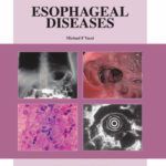 خرید و دانلود نسخه کامل کتاب Esophageal Diseases: An Atlas of Investigation and Management