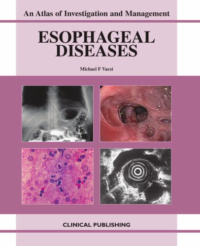 خرید و دانلود نسخه کامل کتاب Esophageal Diseases: An Atlas of Investigation and Management_68b99a468a7f4.jpeg خرید و دانلود نسخه کامل کتاب Esophageal Diseases: An Atlas of Investigation and Management