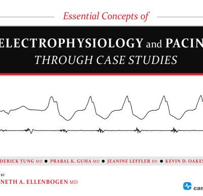 خرید و دانلود نسخه کامل کتاب Essential Concepts of Electrophysiology and Pacing through Case Studies