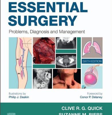 خرید و دانلود نسخه کامل کتاب Essential Surgery: Problems, Diagnosis and Management