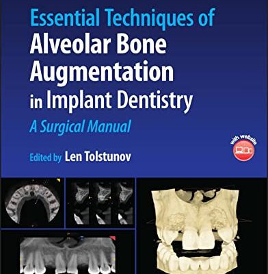 خرید و دانلود نسخه کامل کتاب Essential Techniques of Alveolar Bone Augmentation in Implant Dentistry: A Surgical Manual