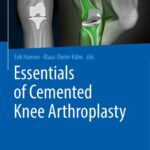 خرید و دانلود نسخه کامل کتاب Essentials of Cemented Knee Arthroplasty