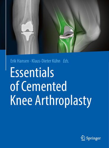 خرید و دانلود نسخه کامل کتاب Essentials of Cemented Knee Arthroplasty_68b628b46ffda.jpeg خرید و دانلود نسخه کامل کتاب Essentials of Cemented Knee Arthroplasty