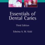 خرید و دانلود نسخه کامل کتاب Essentials of Dental Caries: The Disease and Its Management