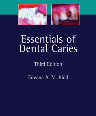 خرید و دانلود نسخه کامل کتاب Essentials of Dental Caries: The Disease and Its Management