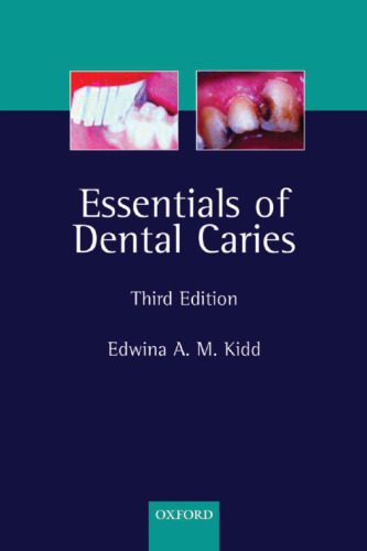 خرید و دانلود نسخه کامل کتاب Essentials of Dental Caries: The Disease and Its Management_68b98e29ab379.jpeg خرید و دانلود نسخه کامل کتاب Essentials of Dental Caries: The Disease and Its Management