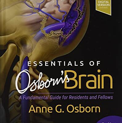 خرید و دانلود نسخه کامل کتاب Essentials of Osborn’s Brain: A Fundamental Guide for Residents and Fellows, 1e (2020)