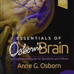 خرید و دانلود نسخه کامل کتاب Essentials of Osborn’s Brain: A Fundamental Guide for Residents and Fellows, 1e (2020)