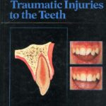 خرید و دانلود نسخه کامل کتاب essentials of traumatic injuries to the teeth