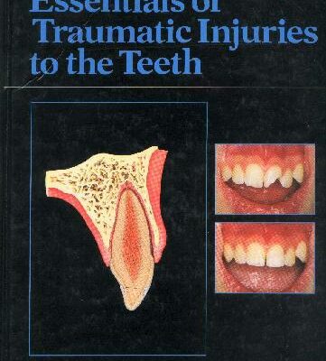 خرید و دانلود نسخه کامل کتاب essentials of traumatic injuries to the teeth
