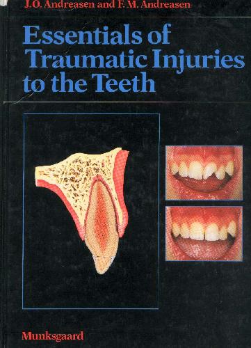 خرید و دانلود نسخه کامل کتاب essentials of traumatic injuries to the teeth_68bbf576e7230.jpeg خرید و دانلود نسخه کامل کتاب essentials of traumatic injuries to the teeth