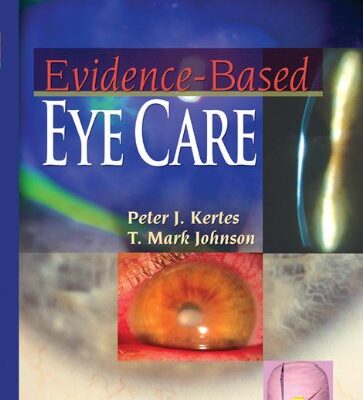 خرید و دانلود نسخه کامل کتاب evidence-based eye care