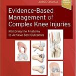 خرید و دانلود نسخه کامل کتاب Evidence-Based Management of Complex Knee Injuries: Restoring the Anatomy to Achieve Best Outcomes