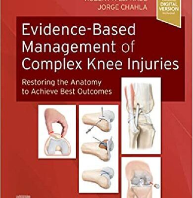 خرید و دانلود نسخه کامل کتاب Evidence-Based Management of Complex Knee Injuries: Restoring the Anatomy to Achieve Best Outcomes