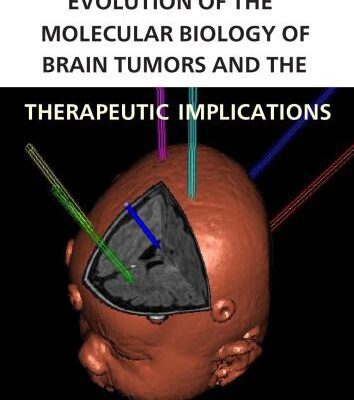 خرید و دانلود نسخه کامل کتاب Evolution of the Molecular Biology of Brain Tumors and the Therapeutic Implications