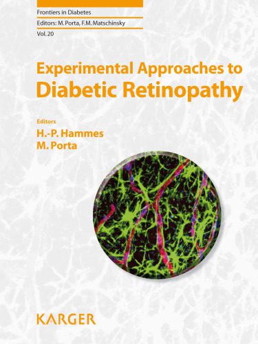 خرید و دانلود نسخه کامل کتاب Experimental Approaches to Diabetic Retinopathy (Frontiers in Diabetes Vol 20)_68ba1733360ce.jpeg خرید و دانلود نسخه کامل کتاب Experimental Approaches to Diabetic Retinopathy (Frontiers in Diabetes Vol 20)