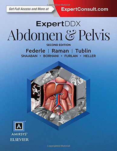 خرید و دانلود نسخه کامل کتاب ExpertDDx: Abdomen and Pelvis, 2e_68b7690b8b194.jpeg خرید و دانلود نسخه کامل کتاب ExpertDDx: Abdomen and Pelvis, 2e