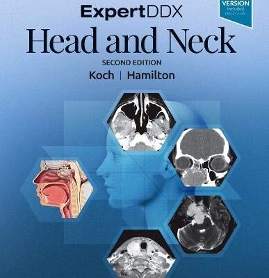 خرید و دانلود نسخه کامل کتاب ExpertDDX: Head and Neck, 2e