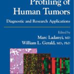 خرید و دانلود نسخه کامل کتاب Expression Profiling of Human Tumors: Diagnostic and Research Applications