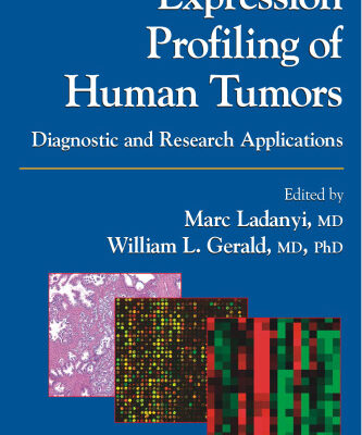 خرید و دانلود نسخه کامل کتاب Expression Profiling of Human Tumors: Diagnostic and Research Applications
