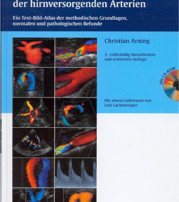 خرید و دانلود نسخه کامل کتاب Farbkodierte Duplexsonographie der hirnversorgenden Arterien