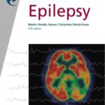 خرید و دانلود نسخه کامل کتاب Fast Facts Epilepsy