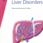 خرید و دانلود نسخه کامل کتاب Fast Facts: Liver Disorders