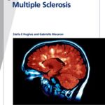 خرید و دانلود نسخه کامل کتاب Fast Facts: Multiple Sclerosis, Fifth Edition