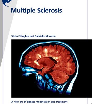 خرید و دانلود نسخه کامل کتاب Fast Facts: Multiple Sclerosis, Fifth Edition