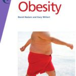 خرید و دانلود نسخه کامل کتاب Fast Facts: Obesity