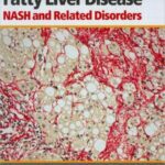 خرید و دانلود نسخه کامل کتاب Fatty Liver Disease: NASH and Related Disorders