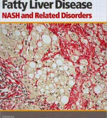 خرید و دانلود نسخه کامل کتاب Fatty Liver Disease: NASH and Related Disorders
