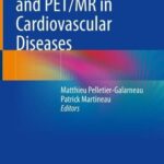 خرید و دانلود نسخه کامل کتاب FDG-PET/CT and PET/MR in Cardiovascular Diseases